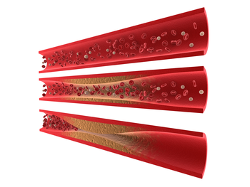 arteries